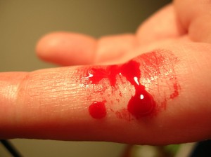 1024px-Bleeding_finger