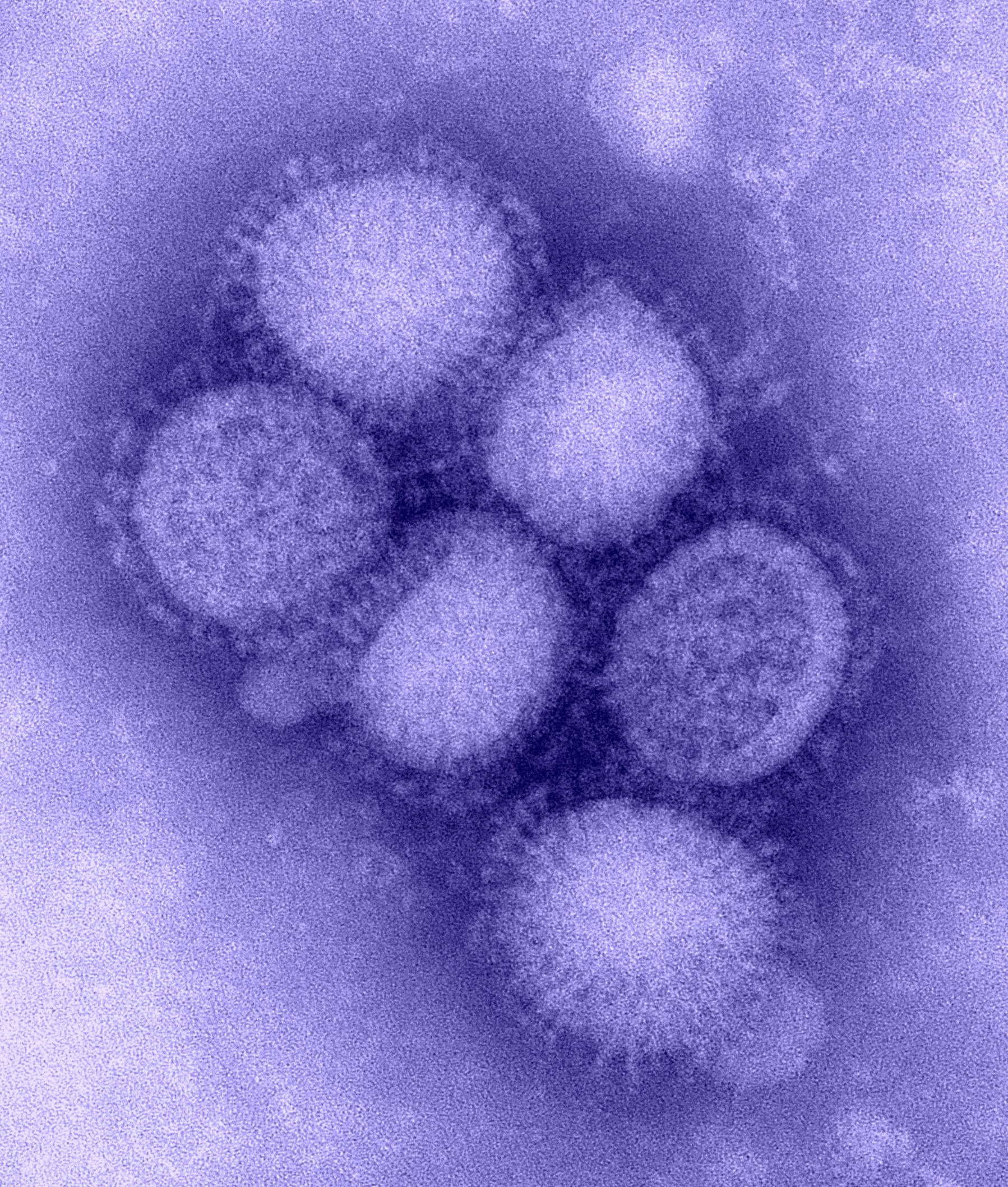 H1N1 influenza virus.