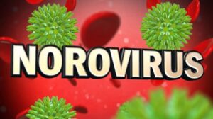 Norovirus.